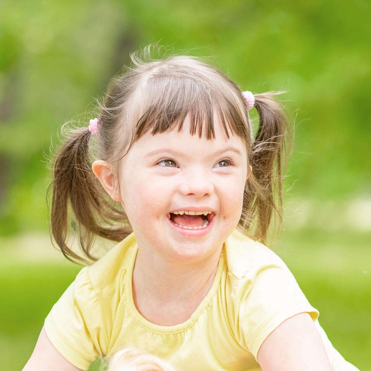 Portrait of a joyful little girl with syndrome down in a summer park. Empty space for text.